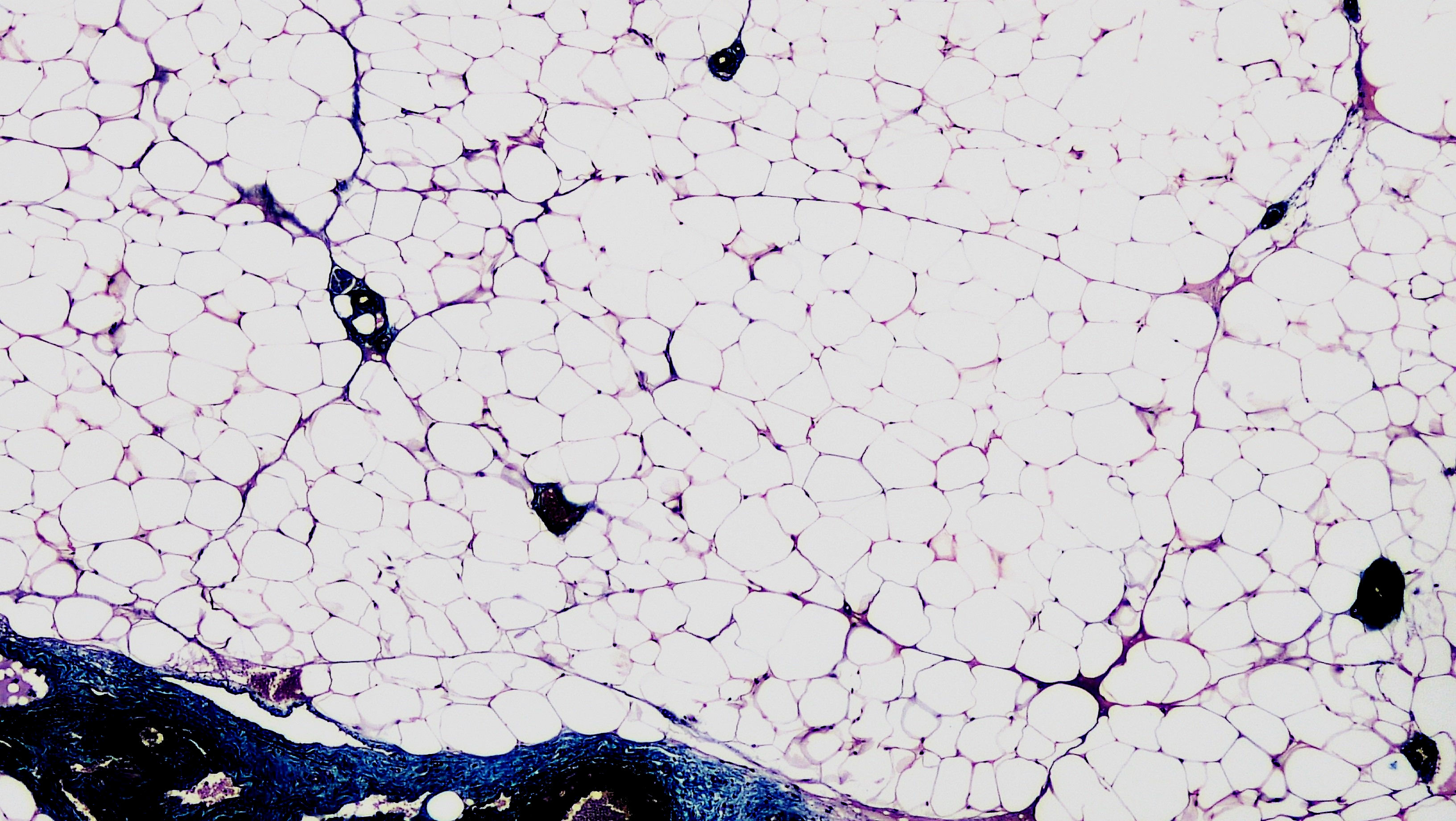 White adipose tissue, histological section. Unilocular adipocytes in connective tissue context, showing the lobular architecture of adipose tissue and the relationship between fat cells and their supporting stroma.