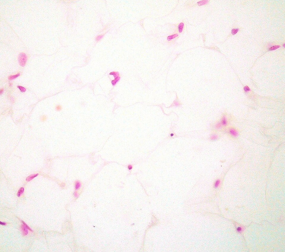White adipose tissue, H&E (inferred). Adipocytes with lipid voids at the centre and peripheral pink nuclei pushed to the cell rim. Ghost-cell morphology is the expected artifact of paraffin processing: lipid dissolves, leaving a clear sphere outlined by a thin cytoplasmic rim and a flattened crescent nucleus.